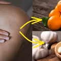 Masz problem z żylakami? Możesz je usunąć dzięki temu domowemu sposobowi!