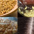Jak pozbyć się łupieżu w naturalny sposób?