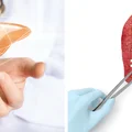 DIETA WĄTROBOWA – co to jest i kiedy stosować?
