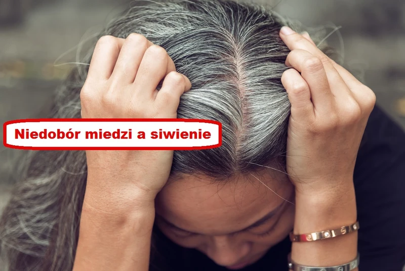 Czy SIWIENIE ma związek z niedoborem MIEDZI?