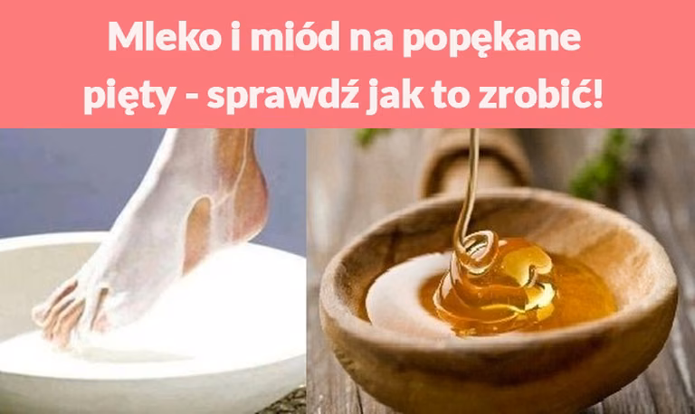 Mleko i miód na popękane pięty - sprawdź jak to zrobić!