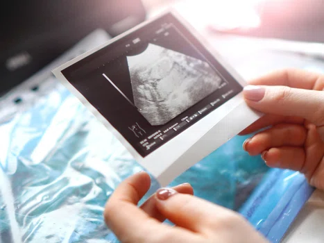 Czym są badania prenatalne ciąży? Czy są refundowane?