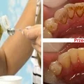 Czym jest OIL PULLING? I dlaczego płukanie ust olejem ma wiele korzyści?