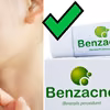 Benzacne - HIT z apteki na zaskórniki za kilkanaście zł!