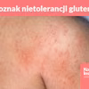 7 oznak nietolerancji glutenu