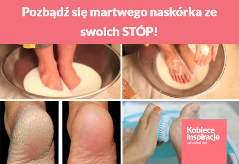 Pozbądź się martwego naskórka ze swoich STÓP!