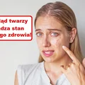 Co Twoja TWARZ zdradza o Twoim zdrowiu?