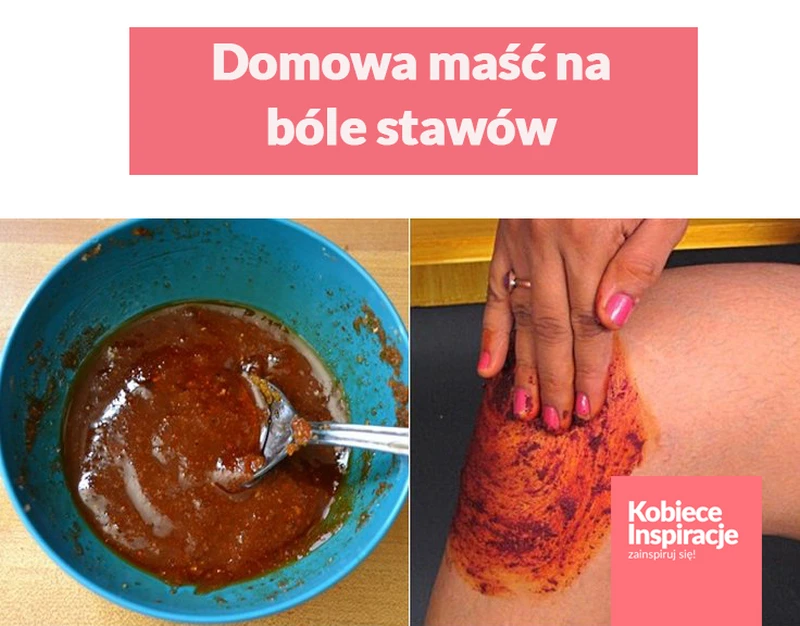 Domowa maść na bóle stawów – dwa najskuteczniejsze składniki
