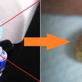 Czy manicure hybrydowy może powodować czerniaka?