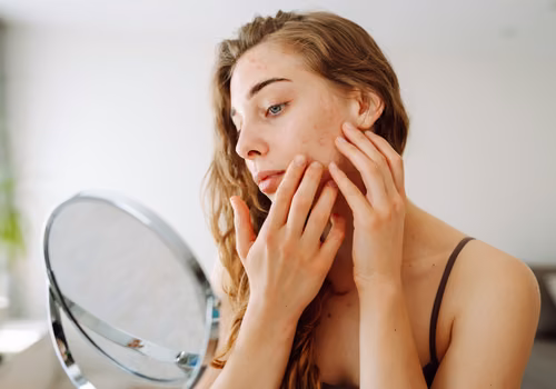Zmiany skórne po zimie - kiedy iść do dermatologa?