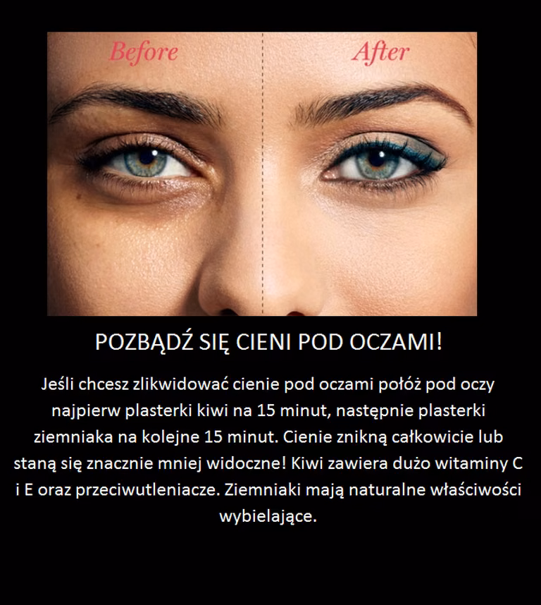 Pozbądź się cieni pod oczami!
