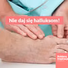 Ćwiczenia, które pomogą Ci zapobiec oraz złagodzić haluksy.