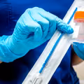 Zaskakujący przełom w medycynie! Nowy test demaskuje chorobę, która dotyka wielu kobiet.