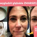 Jak wygładzić głębokie ZMARSZCZKI?