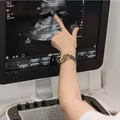 Kluczowe badanie dostępne dla wszystkich kobiet! Od 5 czerwca znika granica wiekowa