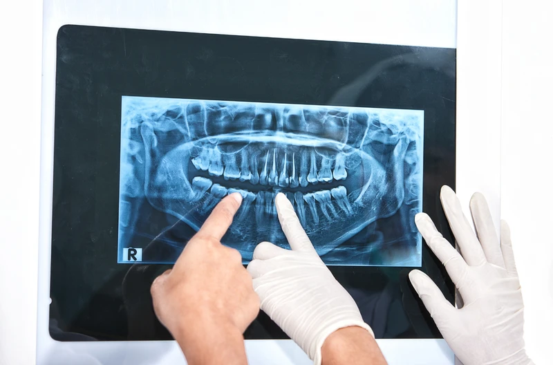 Potężne kolejki do dentysty na NFZ! Odkryj, gdzie czeka się wiecznie, a gdzie w mgnieniu oka!