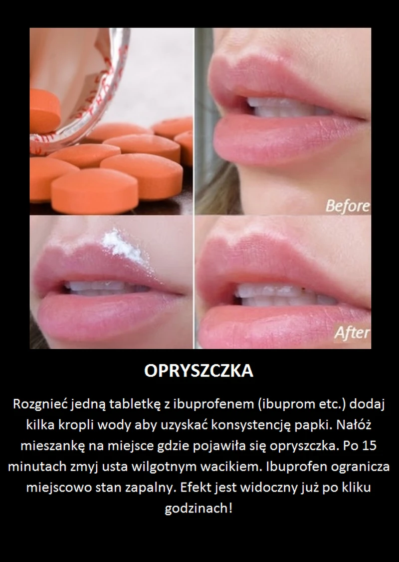 Sposób na opryszczkę, którego nie znasz!