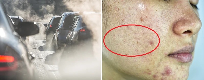 Smog – zobacz, w jaki sposób niszczy cerę!