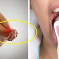 Jakie choroby wmawiają nam firmy farmaceutyczne? Jest ich wiele!