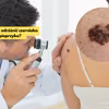 Jak odróżnić pieprzyk od czerniaka?