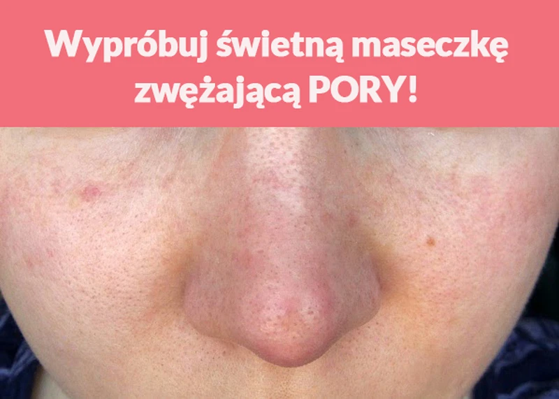 Wypróbuj świetną maseczkę zwężającą PORY!