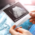 Czym są badania prenatalne ciąży? Czy są refundowane?