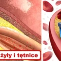 Ta receptura oczyści Twoje TĘTNICE i ochroni Cię przed zawałem!