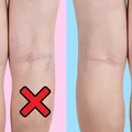 HIT medycyny naturalnej! Zniweluj cellulit, pajączki oraz żylaki. Sprawdź koniecznie!
