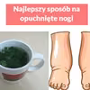 Najlepszy sposób na opuchnięte nogi!