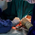 Światowy Dzień Donacji i Transplantacji: Ratujmy Życie Poprzez Świadomość