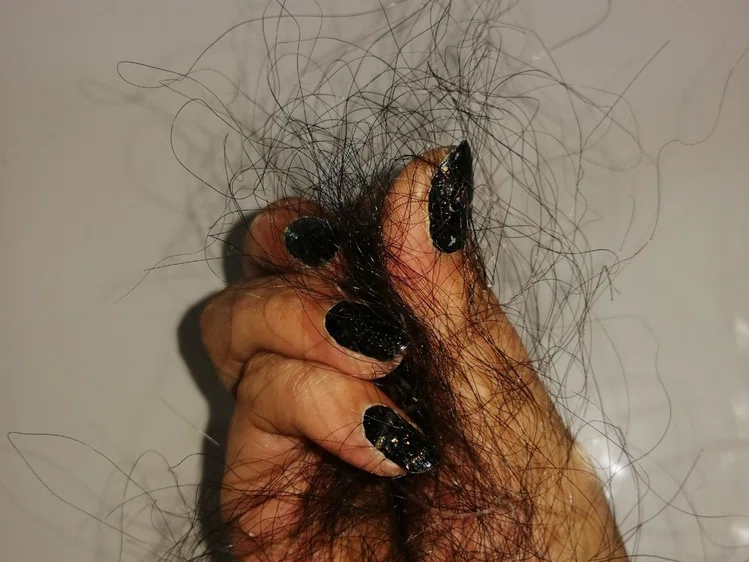 Zdjęcie Nieoczywiste powody wypadania włosów! Poznaj je! #2