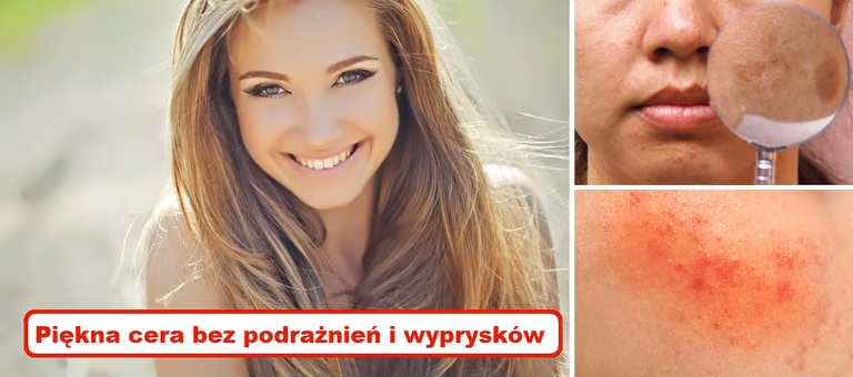 Jeżeli chcesz się cieszyć piękną skórą BEZ PODRAŻNIEŃ I WYPRYSKÓW – pamiętaj o tym!