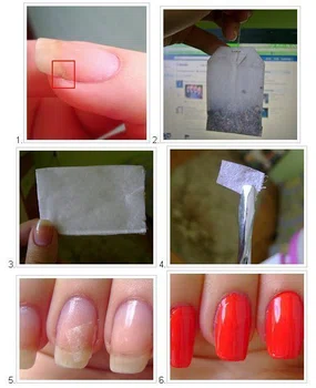 Naderwany paznokieć...??