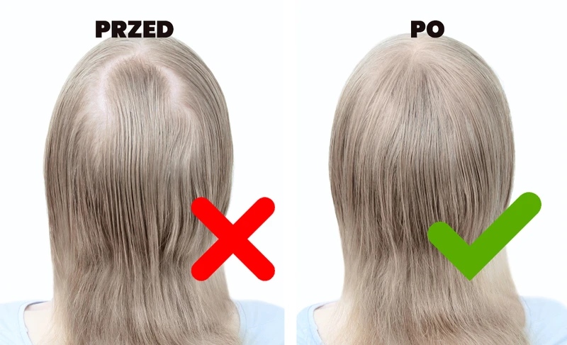 Wypróbuj genialną maseczkę, która przyspieszy POROST WŁOSÓW