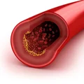 Sposób na obniżenie cholesterolu!