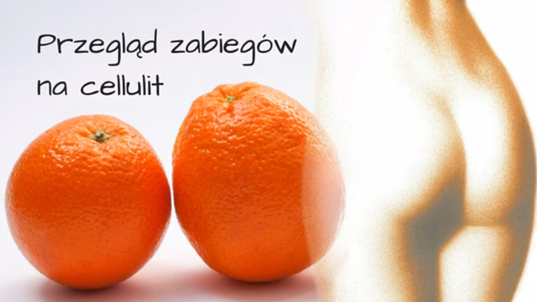 Wybierz swoją broń w walce z cellulitem – przegląd zabiegów
