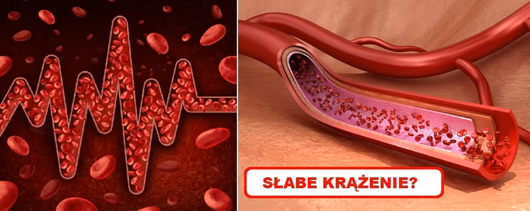 Poznaj sygnały ostrzegawcze które mogą świadczyć o ZŁYM KRĄŻENIU