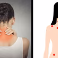 Wstajesz rano zmęczona i obolała? Być może to fibromialgia. Sprawdź jak ją leczyć