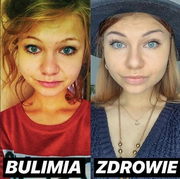 CZUŁAM SIĘ NIC NIE WARTA, CHCIAŁAM ZNIKNĄĆ... O TYM, JAK BULIMIA WPŁYNĘŁA NA ŻYCIE SANDRY. #WYWIAD