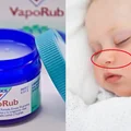 Maść Vicks VapoRub – nigdy nie stosuj jej u małych dzieci!