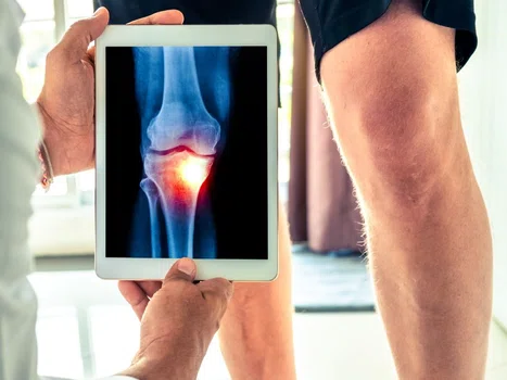 Co może oznaczać ból kolan?