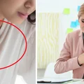 Ostry ból w klatce piersiowej? Być może to Syndrom Hucharda. Czym jest?