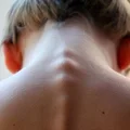 Bezpłatne badania kręgosłupa dla młodzieży