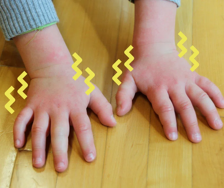 Co mogą oznaczać trzęsące się ręce u dzieci?