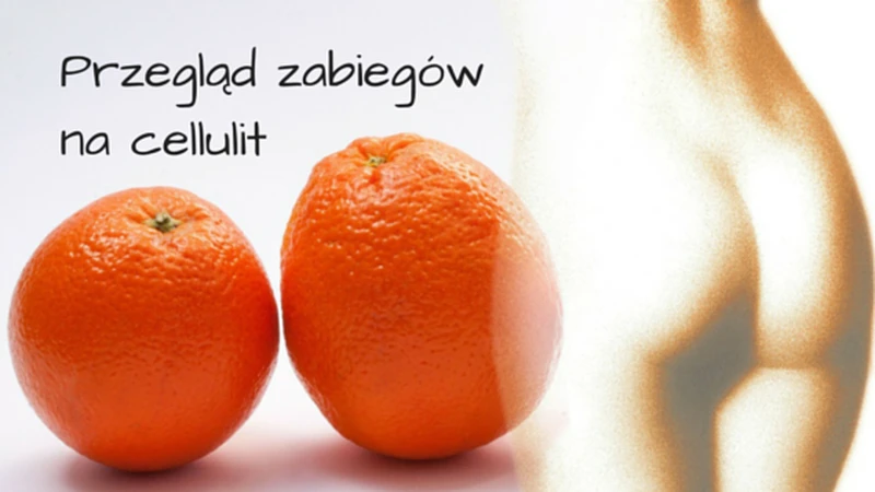 Wybierz swoją broń w walce z cellulitem – przegląd zabiegów