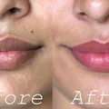 Domowy peeling, który przywraca ustom ich naturalne piękno