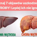 Poznaj 7 objawów uszkodzenia WĄTROBY! Lepiej ich nie ignoruj!