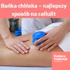 Bańka chińska – najlepszy sposób na cellulit