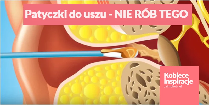 Czyścisz uszy patyczkiem? Sprawdź, dlaczego powinnaś przestać