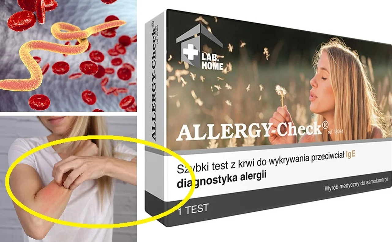 Test z apteki na pasożyty i alergię! Zrób go sama w domu